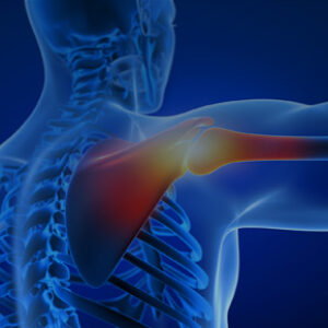 La spalla: valutazione clinica e trattamento riabilitativo