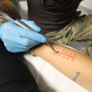 Fibrolisi Connettivale e Fasciale