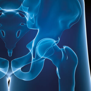 Dolore Pelvi-perineale: Patogenesi, classificazione, valutazione. Cenni di terapia chinesiterapica e strumentale