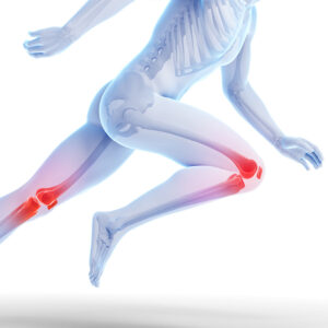 Running Injuries – Valutazione, Prevenzione, Riatletizzazione e ritorno allo sport.