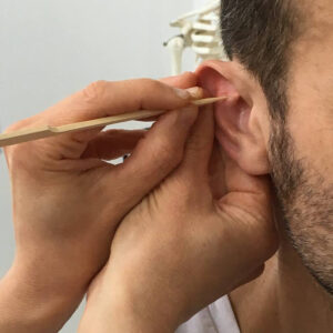 Auricoloterapia nel trattamento del dolore in fisioterapia