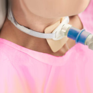 La gestione riabilitativa del paziente con cannula tracheostomica