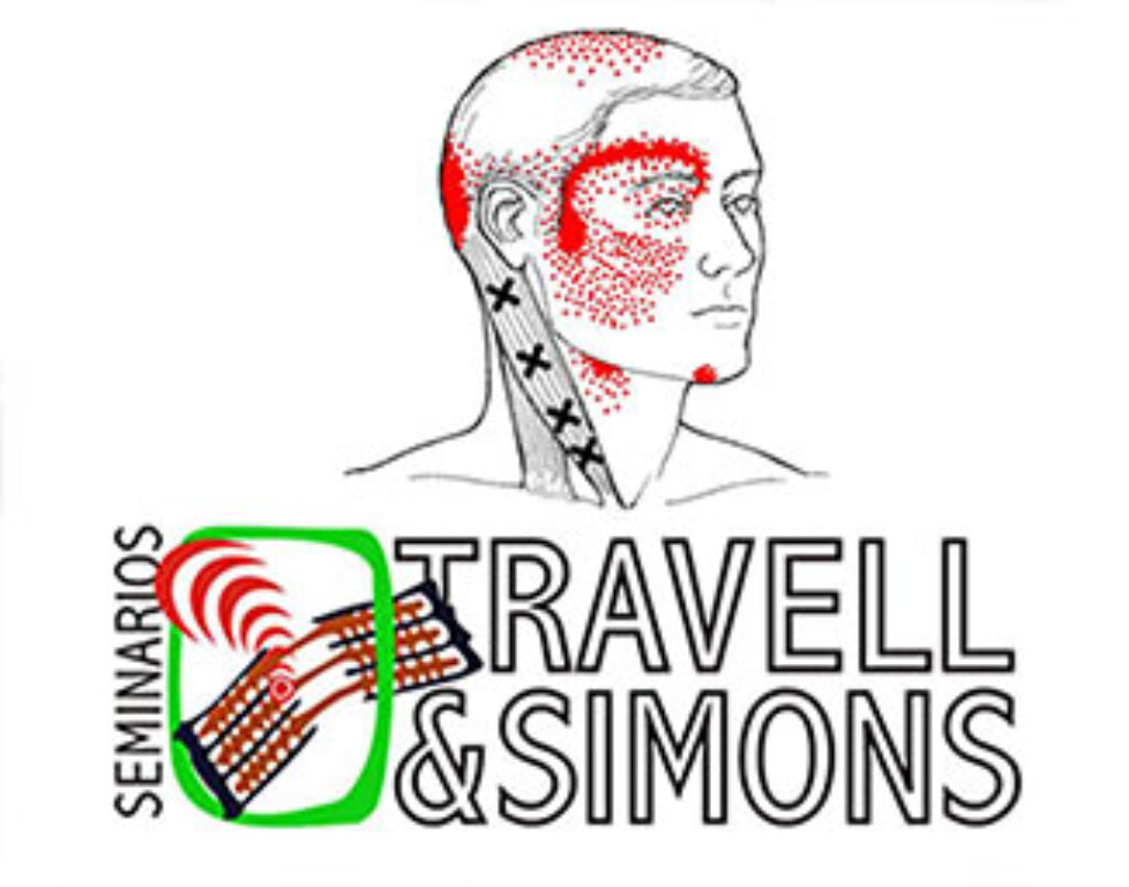 Trigger Point e Sindrome Dolorosa Miofasciale un approccio Evidence