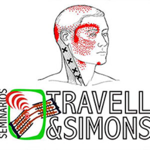 Trigger Point e Sindrome Dolorosa Miofasciale: un approccio Evidence-Based