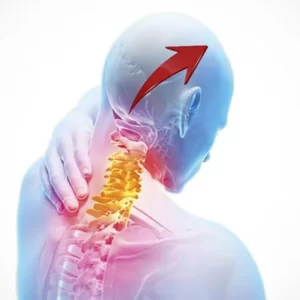 Cefalee primarie e secondarie: Ragionamento Clinico, Terapia Manuale ed Esercizio