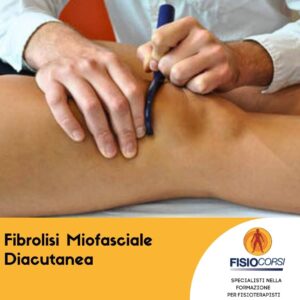 Fibrolisi Miofasciale Diacutanea – ROMA