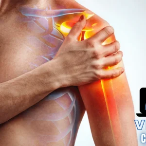 La patologia della Cuffia dei Rotatori: Valutazione Clinica e Trattamento Riabilitativo