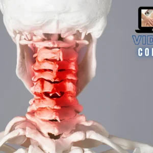 Jones strain counterstrain rachide cervicale