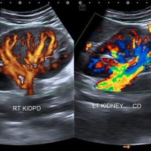 Ultrasound evaluation in visceral manual practice – tre giornate di formazione