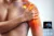 La patologia della Cuffia dei Rotatori: Valutazione Clinica e Trattamento Riabilitativo