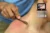 Terapia Manuale Miofasciale integrata Deep Tissue, Lame e Fibrolisori